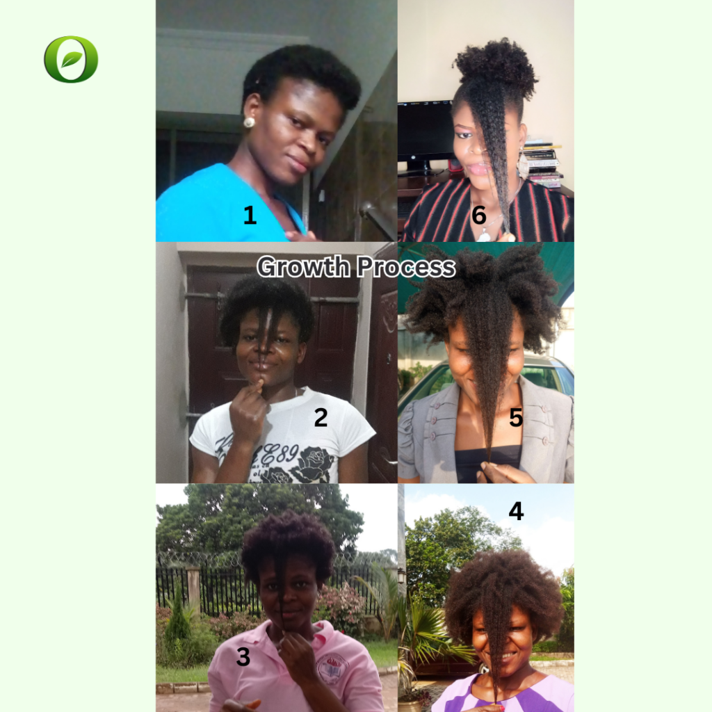 Egojenn Products hair growth Testimonial