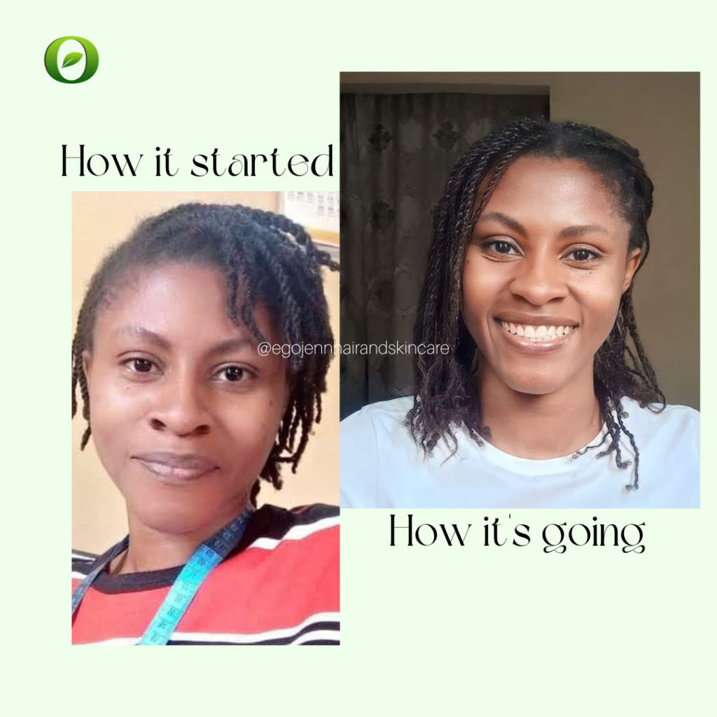 Hair growth before and after by Chinazo