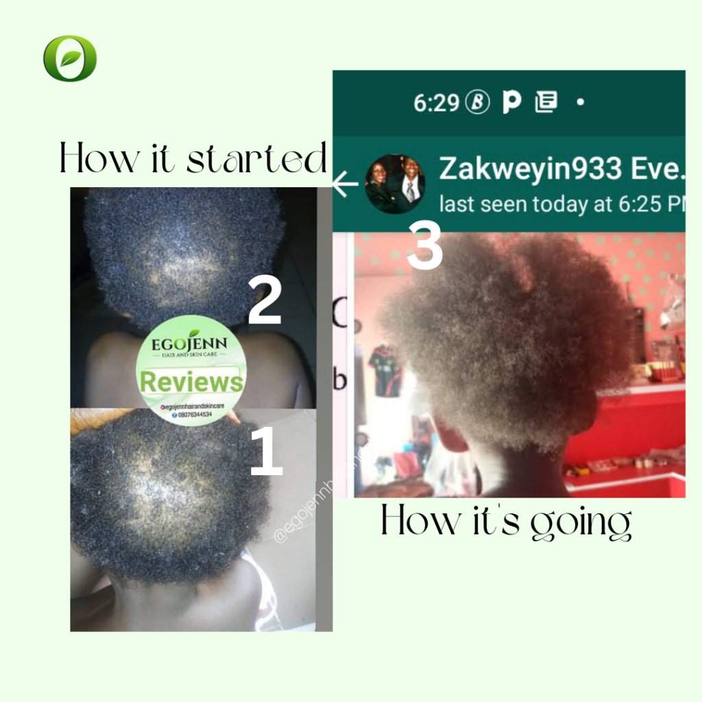 Baby hair recovery